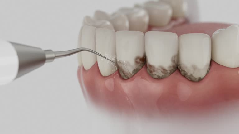 Reliable Emergency Dentist contractor in Yalaha, FL by Smile Center Dentistry